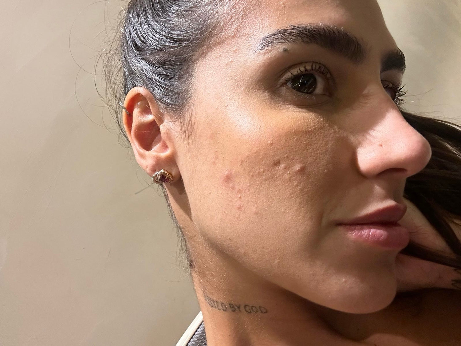Antes do uso do Kit Skincare Rotina Completa