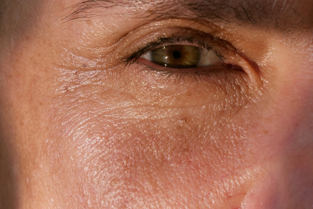 Microbioma da pele: o que é, benefícios e como cuidar