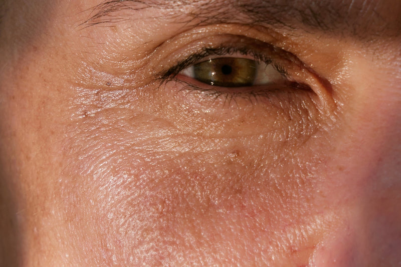 Microbioma da pele: o que é, benefícios e como cuidar