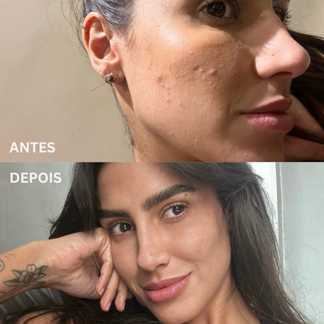 Skin Quer | Kit Skincare Rotina Completa