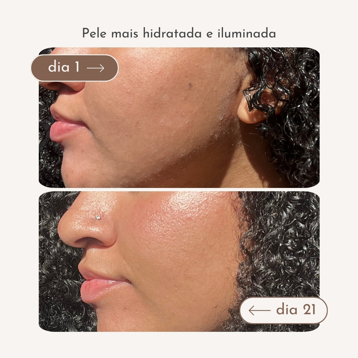 Antes e depois pele ressecada