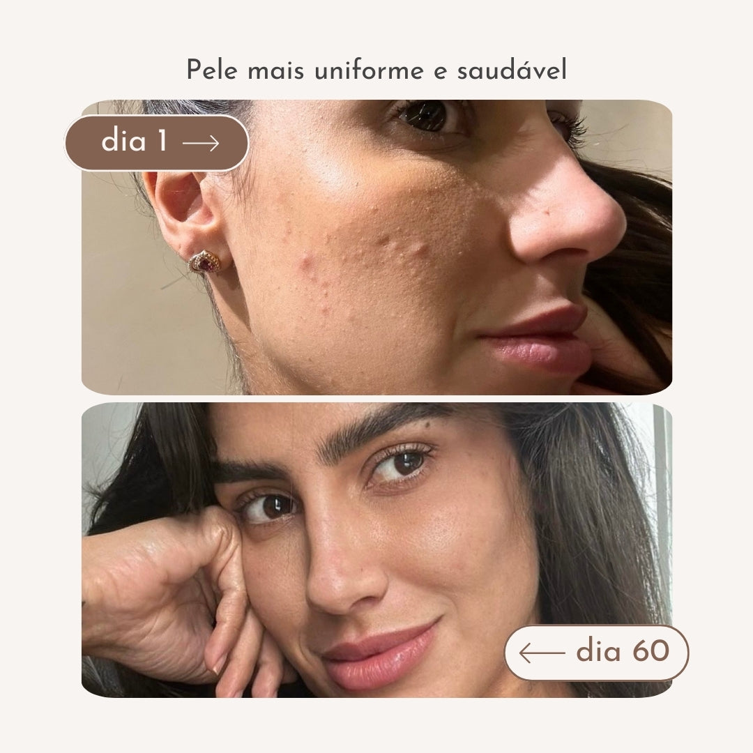 Antes e depois skincare completa