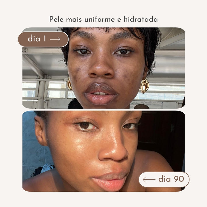 Antes e depois menos manchas