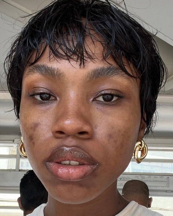 Antes Stace Kit Skin Quer antes
