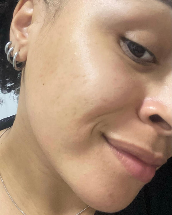 Resultado Amanda Kit Skin Quer depois