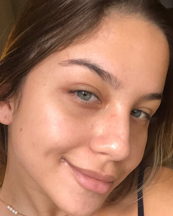 Resultado Narin Kit Skin Quer depois