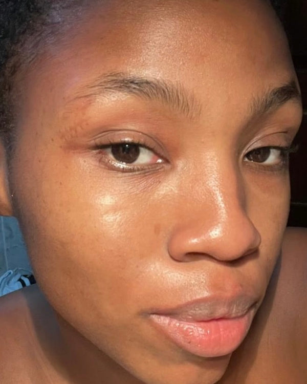 Resultado Stace Kit Skin Quer depois